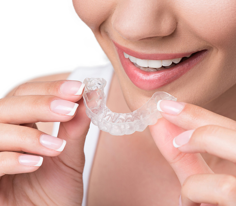 SureSmile Aligners in LaSalle